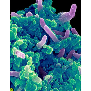 Небачені бактерії 7+ Зухвалі бацили, підступні віруси та хитрі гриби